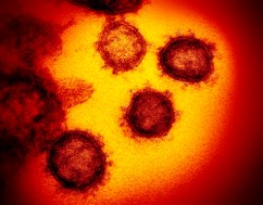 コロナウイルスの写真